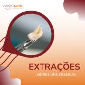 Extrações