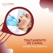 Tratamento de canal