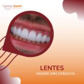 Lentes