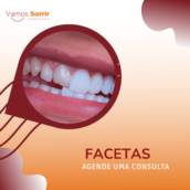 Facetas