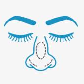 RINOPLASTIA