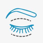 BLEFAROPLASTIA