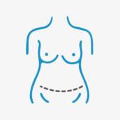 ABDOMINOPLASTIA