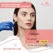 Intradermoterapia no Tratamento de Manchas