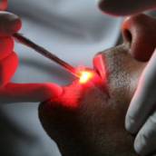 Laserterapia