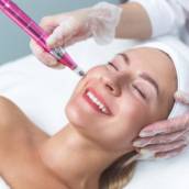 Tratamento com intradermoterapia (Harmony) em Bauru