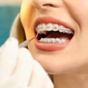 Especialista em Aparelhos Dentários em Bauru