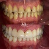 Estética dentária