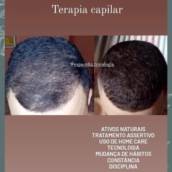 Confira esse resultado da Terapia Capilar