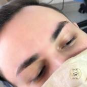 Depilação facial (cera)