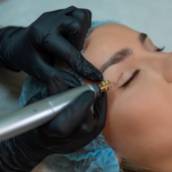 Jato de Plasma - Rejuvenescimento Instantâneo em Avaré/SP