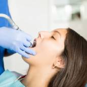 Limpeza dentária (profilaxia) em Bauru