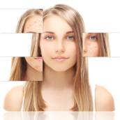 Tratamento de Acne – Controle e Renovação da Pele em São Paulo/SP