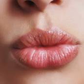 Preenchimento labial