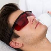 Depilação a laser - Barba 