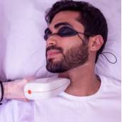 Depilação a laser - Barba Completa