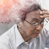 Doença de Alzheimer