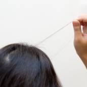 Terapia para tricotomia em Bauru