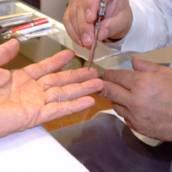Curso de Acupuntura Coreana (Korio)