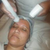 Radiofrequência Facial