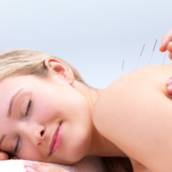 Acupuntura em Resende, RJ por Clínica Torquato