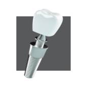 Implante Dentário