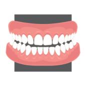 Lente de contato dentária