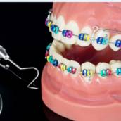 Aparelho Dentário