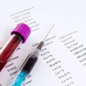 Exame da Fosfatase Alcalina Veterinário em Bauru