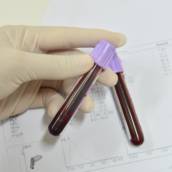 Exame de sangue veterinário de perfil renal: ureia e creatinina em Bauru