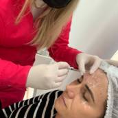 Toxina botulínica (botox) em Bauru