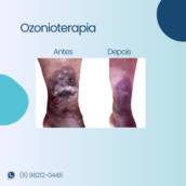 Ozonioterapeuta