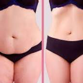 Lipo Laser One S.T.E.P.