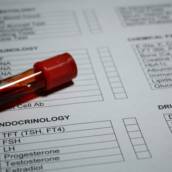Pós-Graduação em Endocrinologia e Metabologia de Pequenos Animais em EAD em Bauru e Região