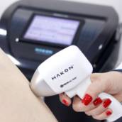 Depilação a Laser 4D em Jundiaí