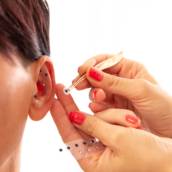 Tratamento de Auriculoterapia em São Manuel/SP