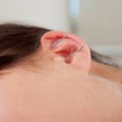 Auriculoterapia