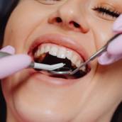 Estética Dental: Sorriso Perfeito e Natural em Uberlândia/MG
