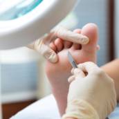 Podologia Pediátrica em Franca: Cuidado Especial para Pequenos Pés - Clínica Roseli Rosendo