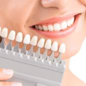  Coroa de Dente em Resina – Solução Estética e Acessível – Qualidade Digna Saúde – Ribeirão Preto/SP