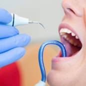  Restauração Simples – Recupere seu Sorriso com Eficácia – Expertise da Digna Saúde – Ribeirão Preto/SP
