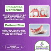 Implante Dentário – Restaure seu Sorriso com Tecnologia e Precisão – Excelência da Digna Saúde