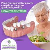 Prótese sobre Implante em Resina – Estabilidade e Estética em Harmonia – Digna Saúde em Ribeirão Preto