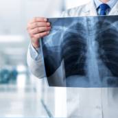  Radiografia de Tórax PA - Diagnosticando com Precisão e Cuidado Respiratório