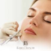 Harmonização Facial em Itapetininga