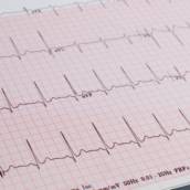 Exame ECG (Eletrocardiograma) em Bauru