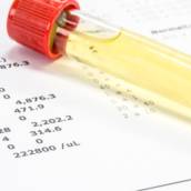 Clinica que faz exames toxicológicos em Bauru