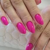 Unhas