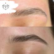 Protocolo Brows Repair - Reconstrução de Sobrancelhas