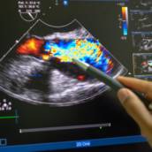 Ultrassonografia de bolsa escrotal com Doppler em Bauru